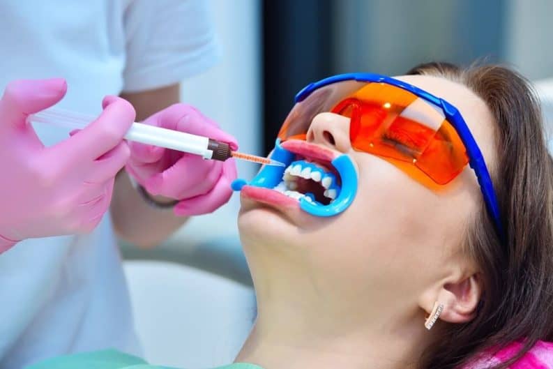 Get a brighter smile in minutes with instant results whitening Basildon