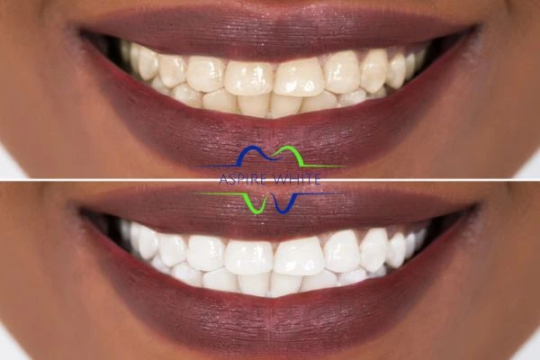 Side-by-side comparison showing before and after results of a cosmetic treatment Basildon