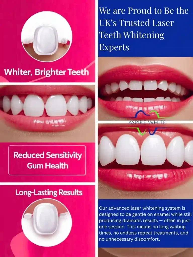 We are Proud to Be the UK’s Trusted Laser Teeth Whitening Experts Basildon