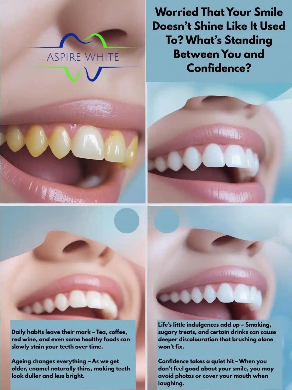 Worried That Your Smile Doesn’t Shine Like It Used To What’s Standing Between You and Confidence Basildon